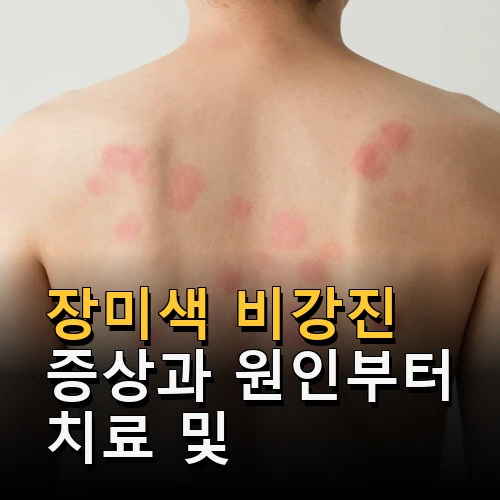 장미색 비강진