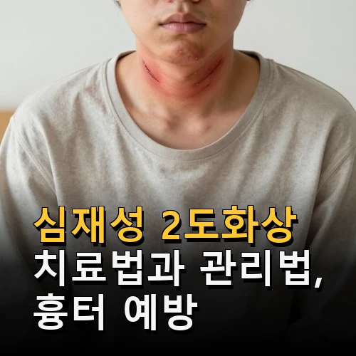심재성 2도화상