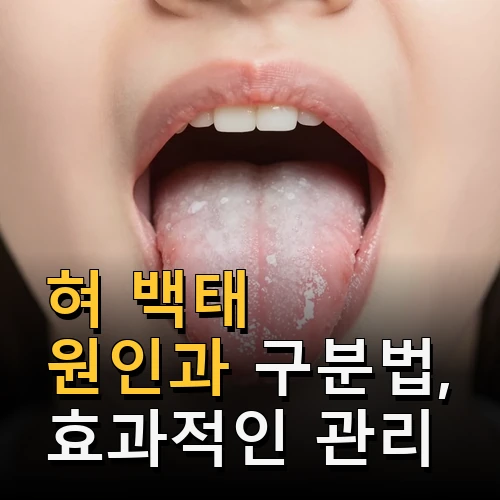 혀 백태 원인