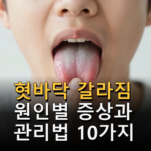 혓바닥 갈라짐
